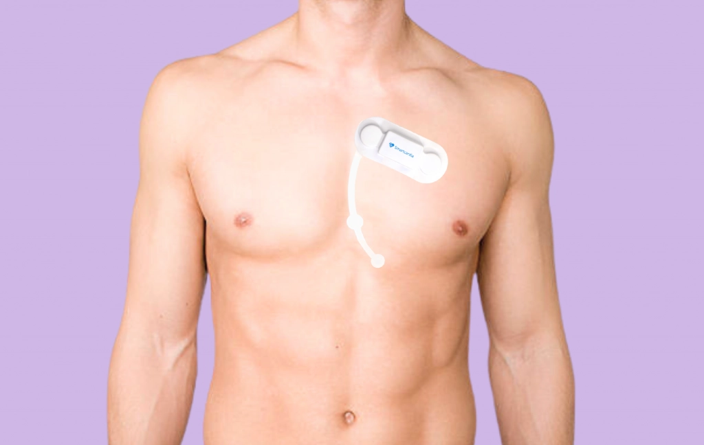 Holter Monitor